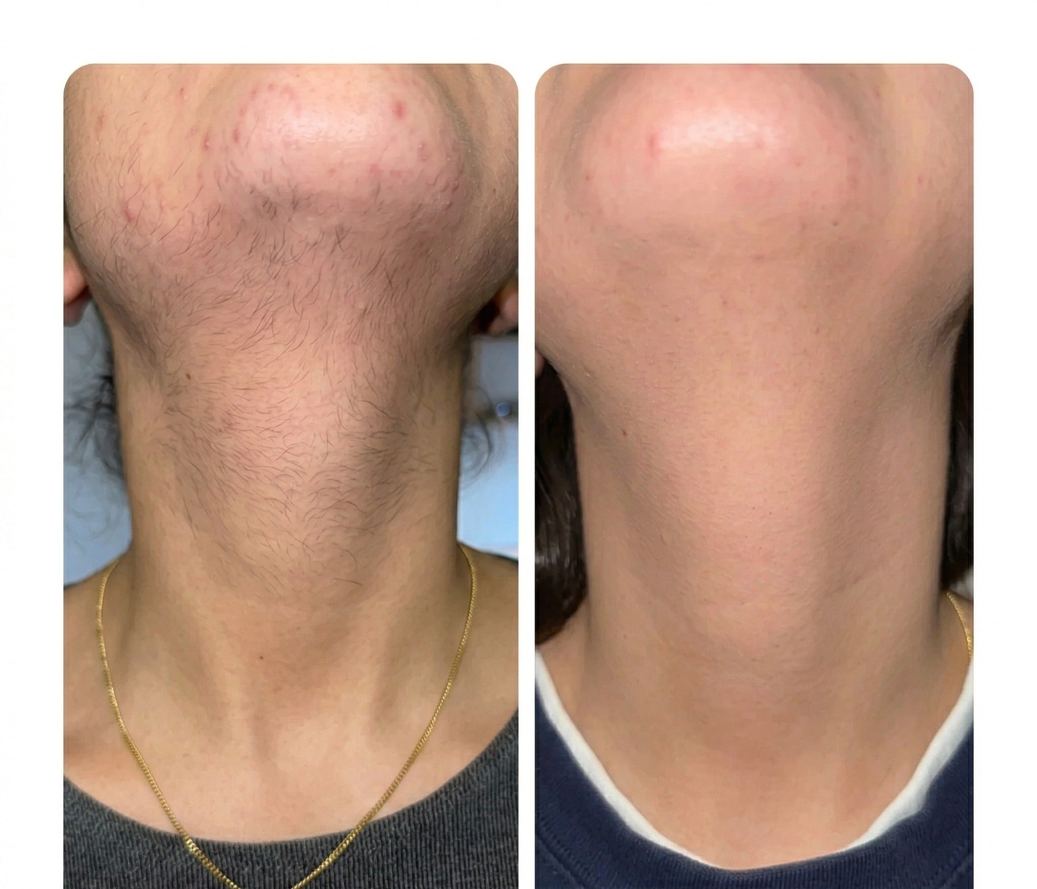 Résultat client — Chloé F.