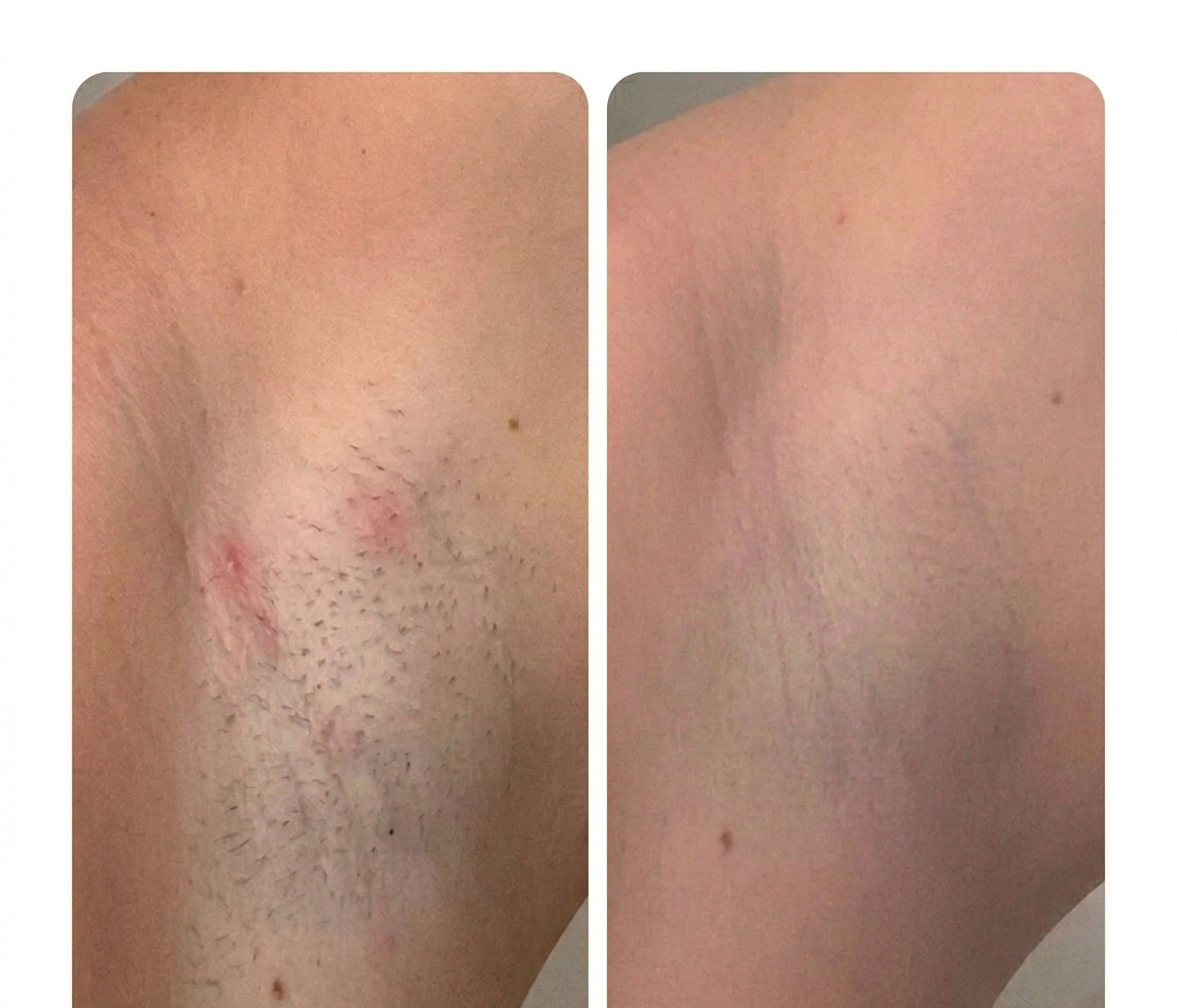 Résultat client — Camille D.