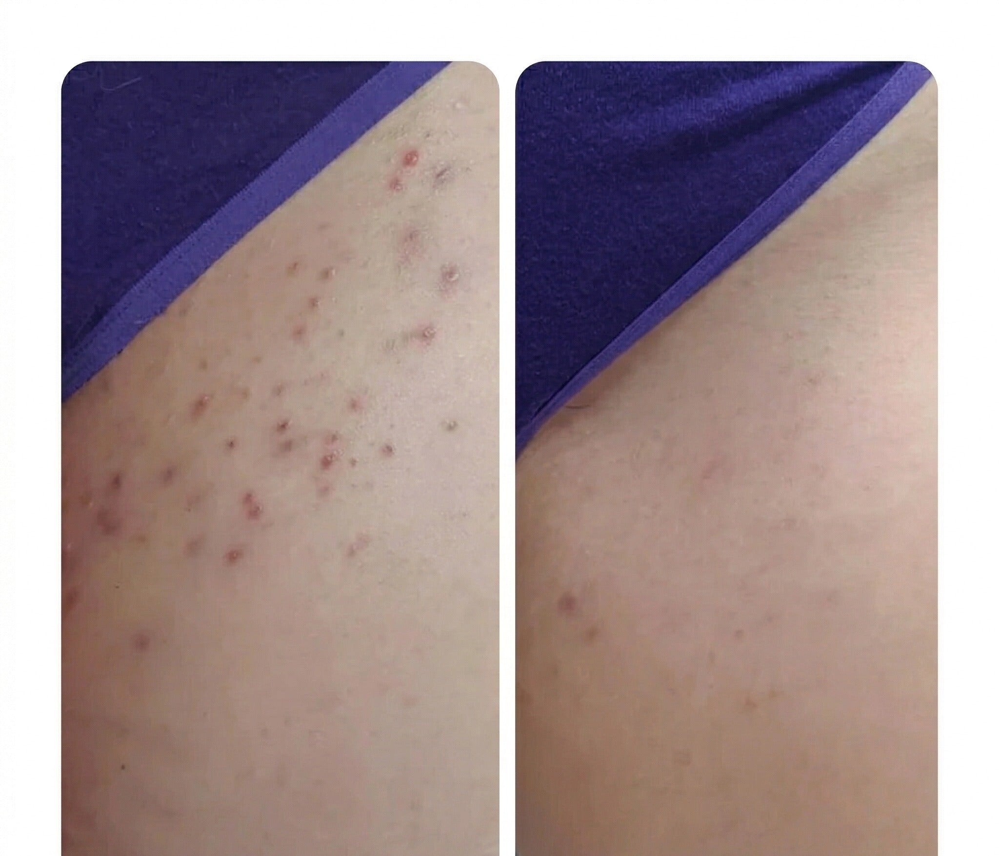 Résultat client — Inès B.